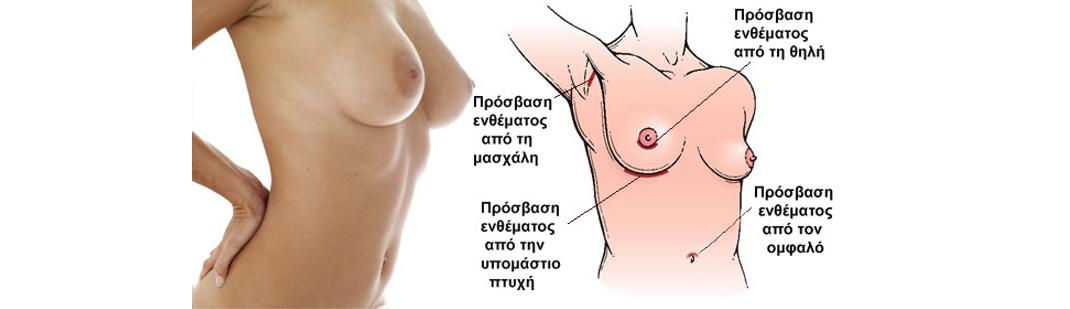 prosvash enthematos breast